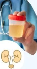 Urine Routine