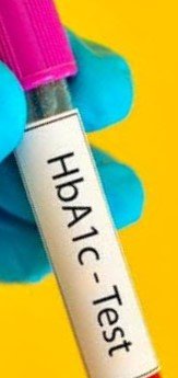 HBA1C test